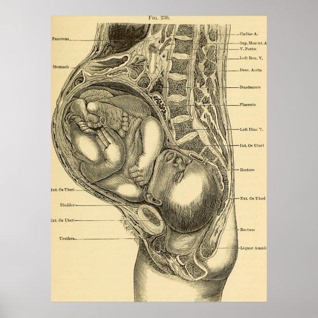 Póster Ilustracion Obstetrics (Frente)