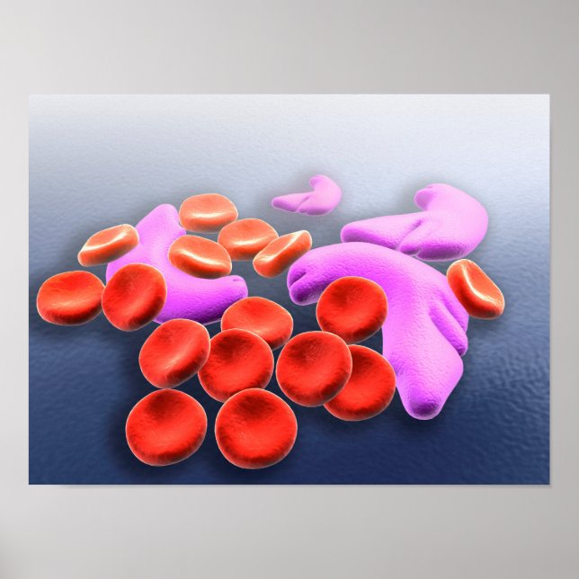 Póster Imagen conceptual de anemia falciforme (Frente)