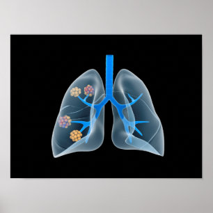 Póster Imagen Conceptual Del Corazón Humano 4