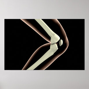 Póster Imagen de la radiografía de la rodilla 1