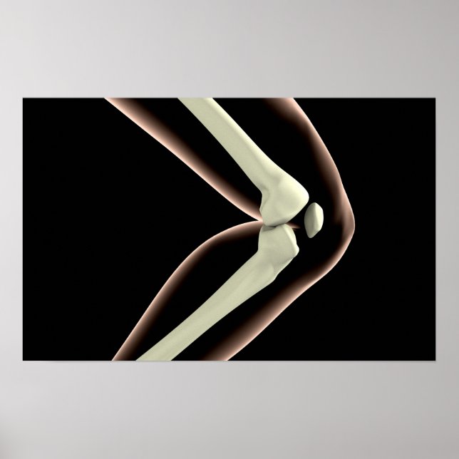 Póster Imagen De Rayo X De Knee 1 (Frente)