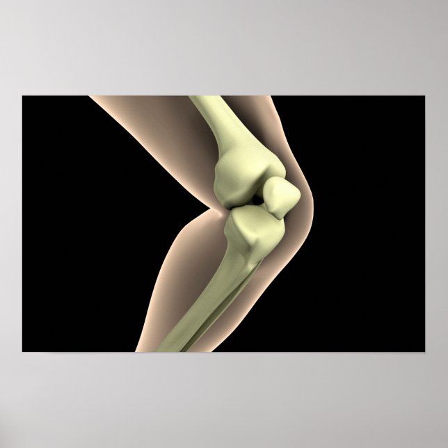 Póster Imagen De Rayo X De Knee 2 (Frente)