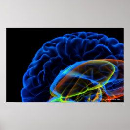 Póster Imagen de rayos X del cerebro