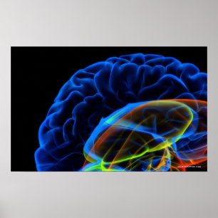 Póster Imagen de rayos X del cerebro