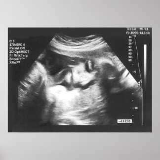 Póster Imagen de ultrasonido falso