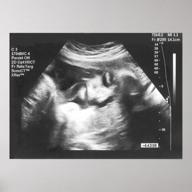 Póster Imagen de ultrasonido falso (Frente)