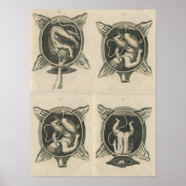 Póster Justine Siegemund Court Midwoman Baby Nació (Frente)