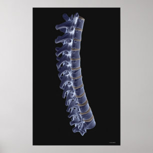 Póster La columna vertebral 3