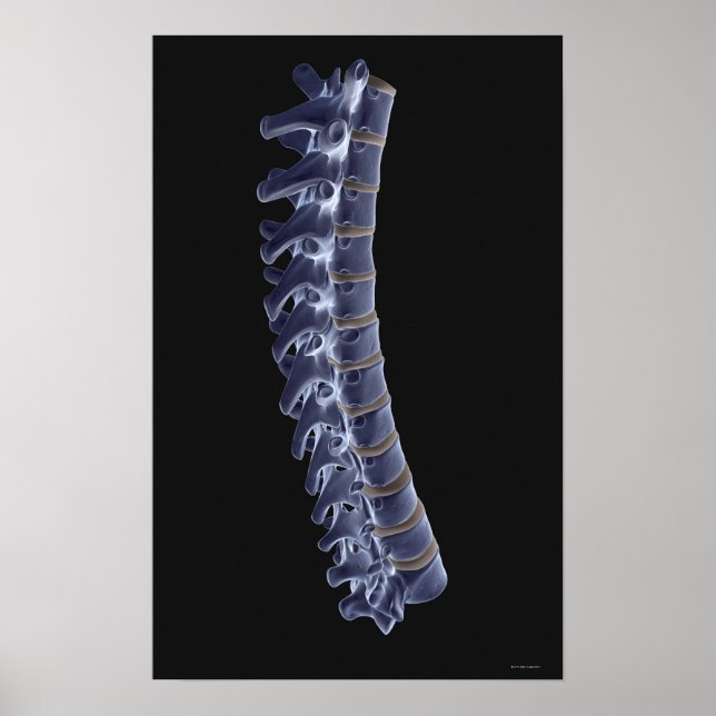 Póster La columna vertebral 3 (Frente)