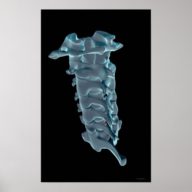 Póster La vértebra cervical (Frente)