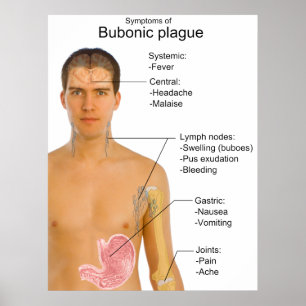 Póster Main Symptoms of Black Death Bubonic Plague Chart