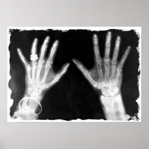 Póster Manos y joyas de esqueleto de rayos X - B&W