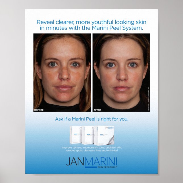 Póster Marini Peel System 8x10" (Frente)