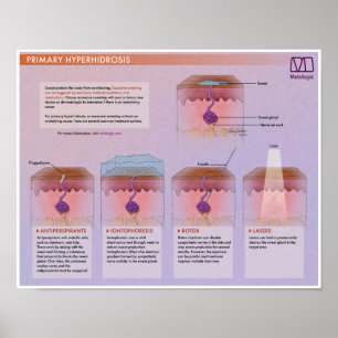 Póster Melalogic Hiperhidrosis Poster médico