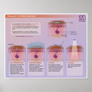 Póster Melalogic Hiperhidrosis Poster médico