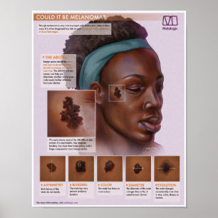 Póster Melalogic Melanoma Poster Médico