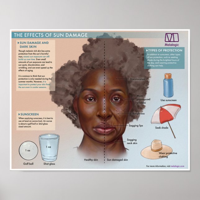 Póster Melalógico Los efectos de los daños del sol Poster (Frente)