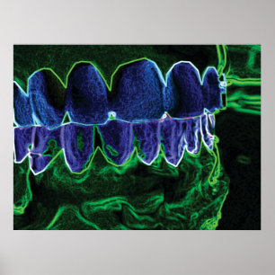 Póster Modelo de dientes de Guay Poster ortodoncista dent