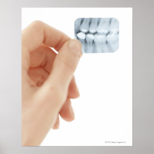 Póster MODELO LANZADO. Radiografía dental