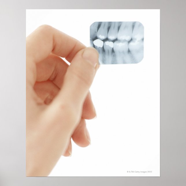 Póster MODELO PUBLICADO. Radiografía dental. (Frente)