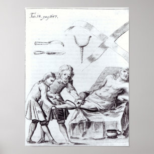 Póster Operación quirúrgica para amputar una pierna