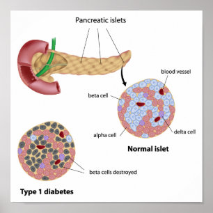 Póster Pancreatic islet and diabetes Poster