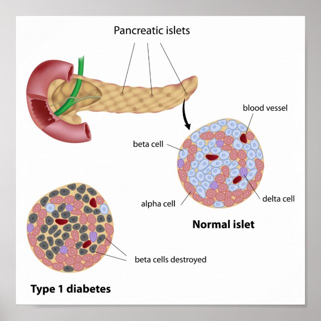 Póster Pancreatic islet and diabetes Poster (Frente)