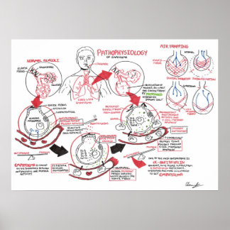 Póster Patofisiología de la emfisema