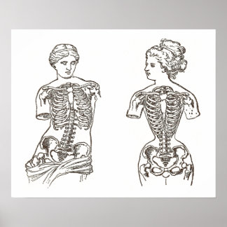 Póster Physical Impact of Wearing Corsets Medical Print