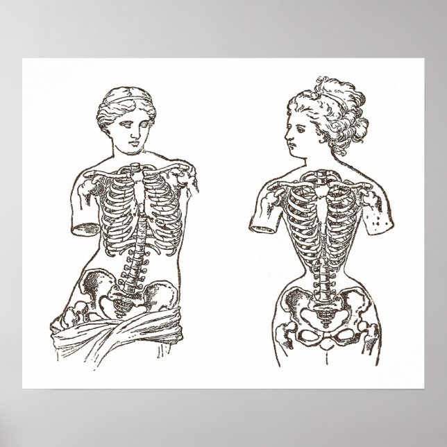 Póster Physical Impact of Wearing Corsets Medical Print (Frente)