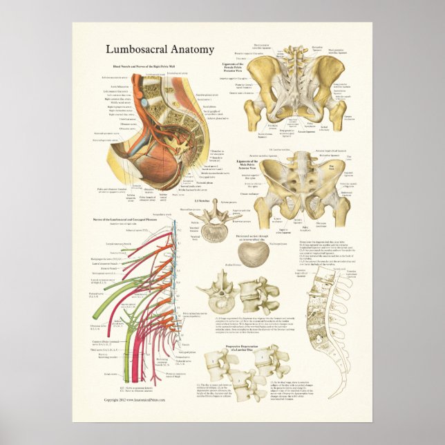 Póster Poster de anatomía lumbosacra y degeneración de es (Frente)