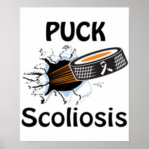 Póster Poster De La Scoliosis Causas