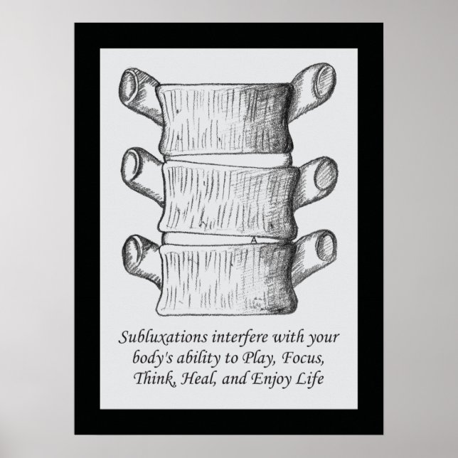 Póster Poster de presupuesto de subluxación quiropráctica (Frente)