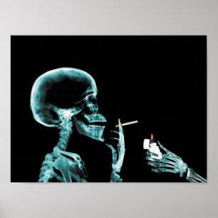 Póster poster de rayos X para fumar