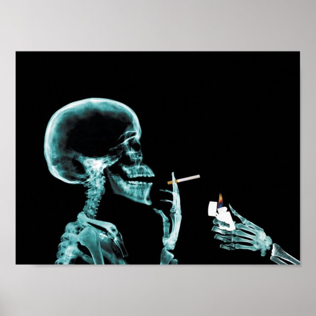 Póster poster de rayos X para fumar (Frente)