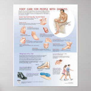 Póster Poster del cuidado de pie de la diabetes - carta
