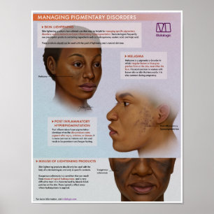 Póster Poster Médico de Aclaramiento de Piel Melalógico