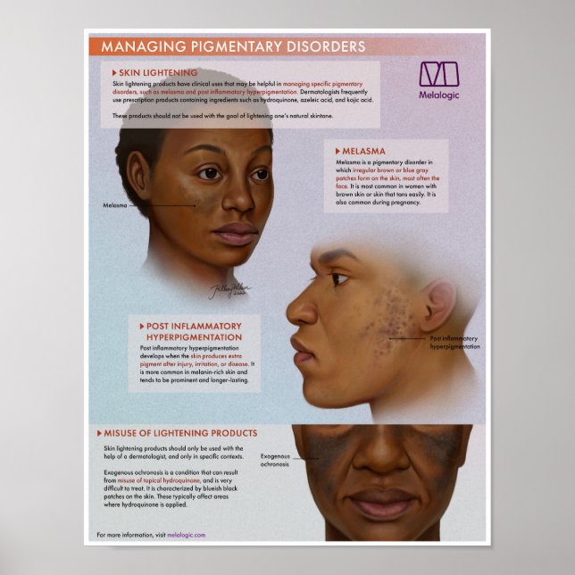 Póster Poster Médico de Aclaramiento de Piel Melalógico (Frente)