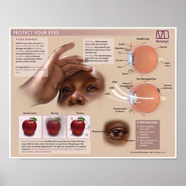 Póster Poster Médico de Protección Ocular Melalógica (Frente)