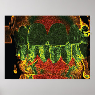Póster Poster ortodoncista demente de dientes