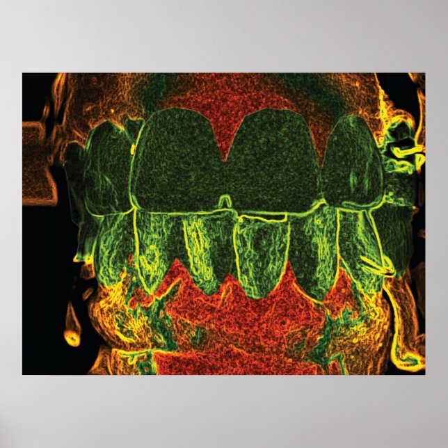 Póster Poster ortodoncista demente de dientes (Frente)
