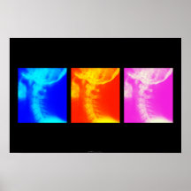 Poster quiropráctico de rayos X cervicales 1