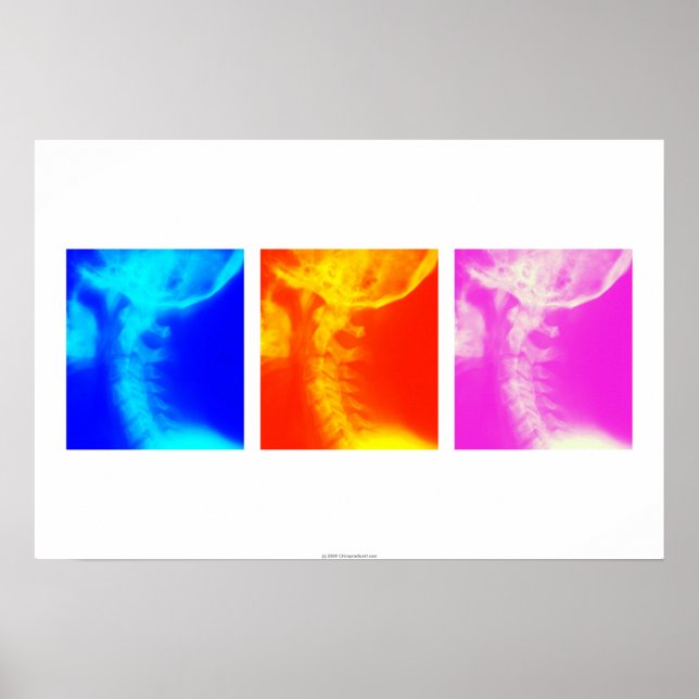 Póster Poster quiropráctico de rayos X cervicales 2 (Frente)