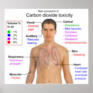 Póster Principales síntomas de la tabla de toxicidad por