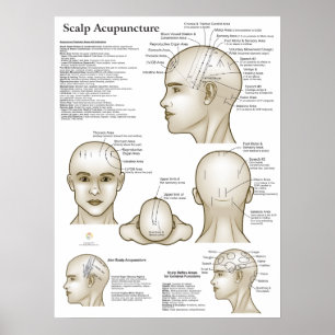 Póster Puntos de Acupuntura en la Cabeza del Cuero Cabell