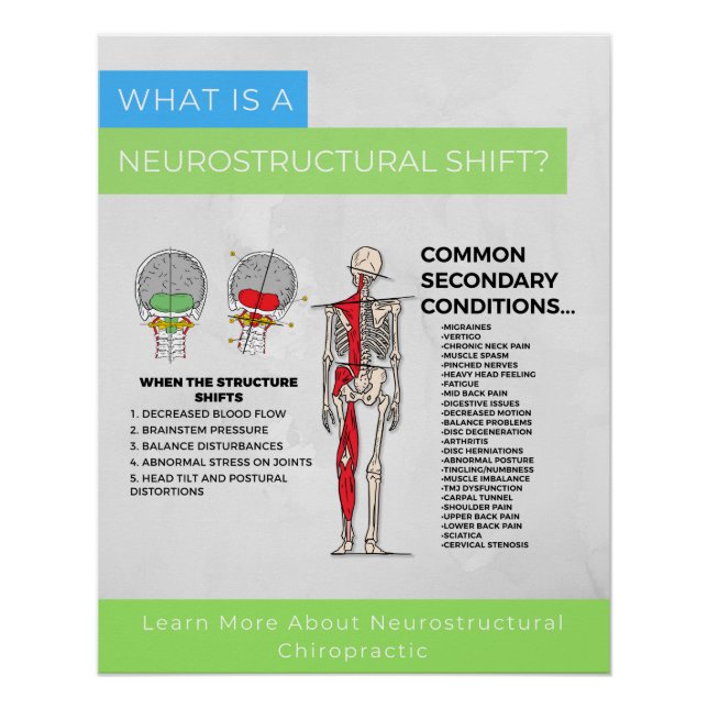 Póster ¿Qué es? (Anverso)