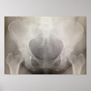 Póster Radiografía de la pelvis