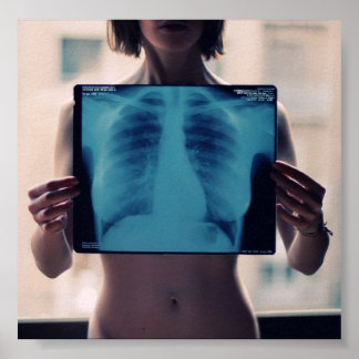 Póster radiografía de tórax para chicas