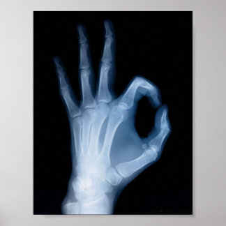 PÓSTER RAY X A-OK