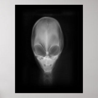 Póster Rayo X Alien Skull
